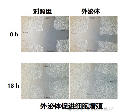促進(jìn)細(xì)胞生長