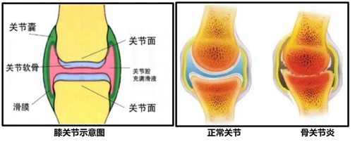 膝關(guān)節(jié)示意圖